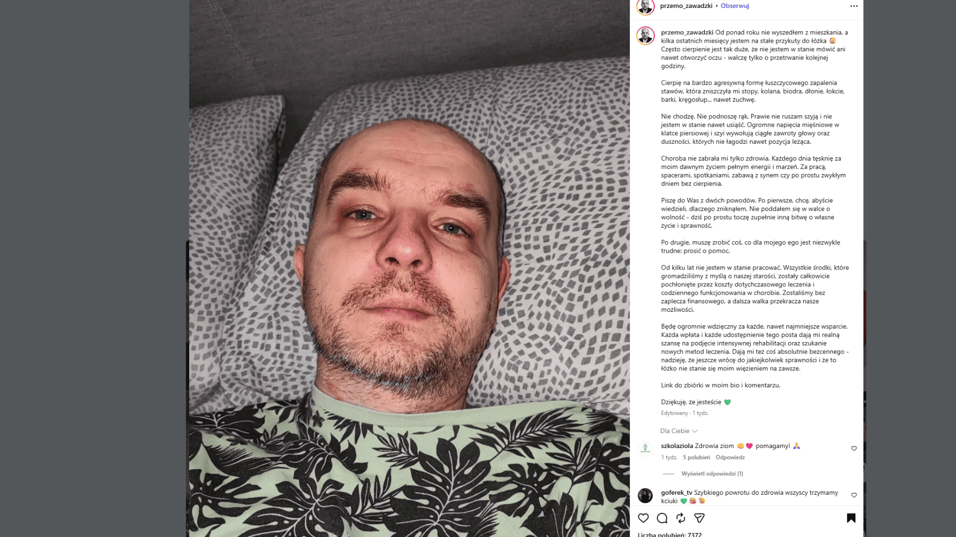 ruszyła zbiórka dla Przemka Zawadzkiego